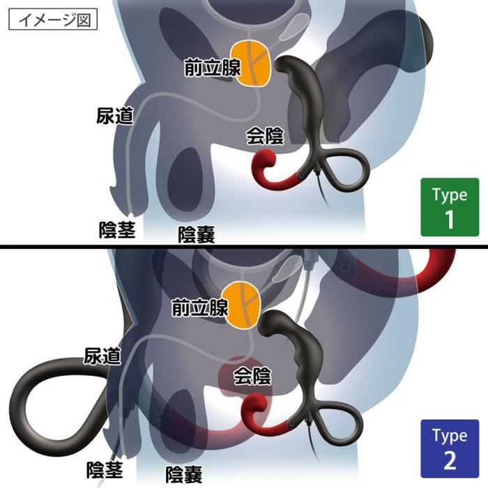 ENEMABLE R 男士前列腺震動器